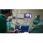 Custom Anestesia Videolaryngoscopy Macintosh Intubation Scope Devices for sale