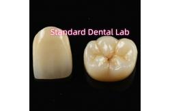 China Biocompatible Material Aesthetic Zirconia Crown Zirconia Bridge Teeth supplier