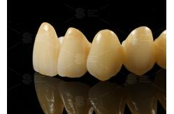 China Strong Aesthetic Porcelain Fused To Zirconia For Natural Looking Restorations supplier