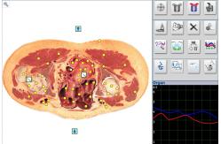 China Newest Metatron Hunter NLS System 4025 Bioresonance Health Scan and Therapy supplier