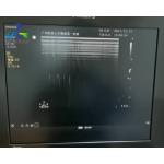  Sparq Ultrasound Machine Repair Abnormal Image Replace Channel Board 453561184013 for sale