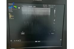 China  Sparq Ultrasound Machine Repair Abnormal Image Replace Channel Board 453561184013 supplier