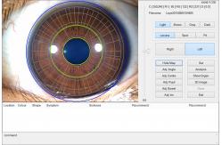 China 12.0MP Digital Iriscope Iridology Camera Eye Testing Machine CE/DHL Approval supplier
