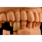 Internal Hex Connection Sandblasted Titanium Dental Implants Single Tooth Replacement