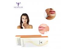 China Neofiller 2ml Hyaluronic Acid Injection Dermal Filler With Lido supplier