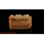 Solid Dental Lab Crowns 3D Pro High Translucency Full Zirconia Crowns with 5-Year Guarantee for sale