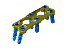 China Titanium Vertebra Spinal Anterior Cervical Fixation For Surgery supplier
