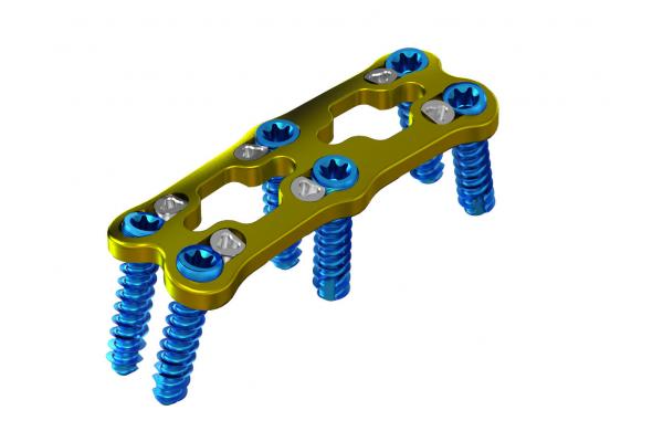 Titanium Vertebra Spinal Anterior Cervical Fixation For Surgery