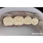 Excellent White Product Full Zirconia With High Resistance To Corrosion Capability for sale