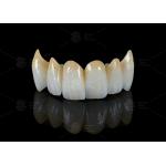 High Translucency Full Contour Zirconia Bridge Chipping Resistance Natural Esthetics for sale