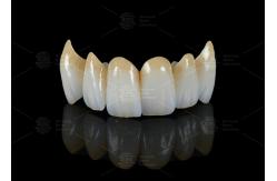 China High Translucency Full Contour Zirconia Bridge Chipping Resistance Natural Esthetics supplier