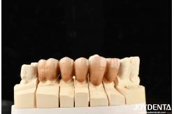 China Bionic Development Leaves And Distinct Layers Of Zirconia All-Ceramic supplier