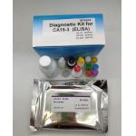 Ce Approved Elisa Test Kit One Step Medical Diagnostic Device For Hbcab Igm for sale