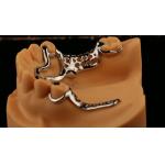 Upper Cast Metal Framework Partial Dentures Strong Lightweight And Durable