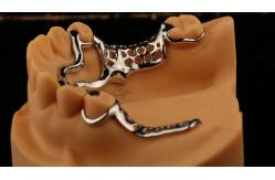 China Upper Cast Metal Framework Partial Dentures Strong Lightweight And Durable supplier