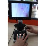 High Definition LCD Microcirculation Checking Microscope Nailfold Video Detection Instrument for sale