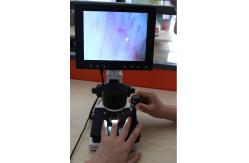 China High Definition LCD Microcirculation Checking Microscope Nailfold Video Detection Instrument supplier