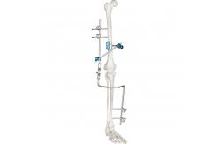 China Medical Knee Joint External Fixation Device Orthopedic Surgical Instruments supplier