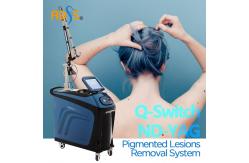 China Stationary Picosecond Laser Machine  1064nm Multifunction Hair Removal Machine supplier