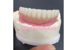 China Esthetic Restoration All On 4 Dental Implants Zirconia Hypo Allergenic supplier