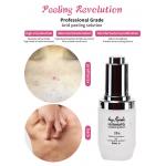 Exfoliating Serum Skin Peeling Solution Acne Remover Skin Care Skin Peeling 30ml for sale