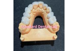 China High Esthetic Hollywood Smile Milling Emax Laminate Veneers supplier