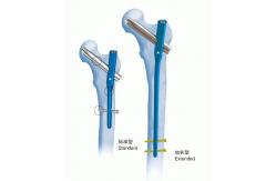 China Orthopedics Titanium Gamma Interlocking Nail Ⅳ PFN supplier