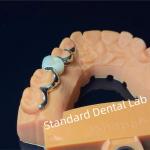 Dental Teeth PFM Maryland Bridge High Esthetics FDA Certified for sale