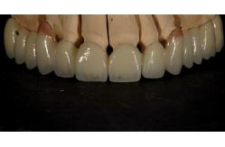 China Good Fitting Good Esthetics Multi Layered Zirconia Crown Porcelain Zirconia Bridge supplier