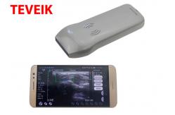 China Portable Wireless Ultrasound Probe Medical Ultrasonic Convex Probe Doppler Scanner supplier