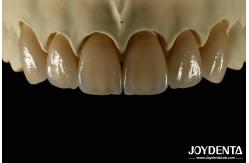 China Bionic Development Leaves And Distinct Layers Of Zirconia All-Ceramic supplier