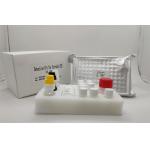 Serum Plasma Diagnostic Test Igg Elisa Kit For Hepatitis B Core Antigen for sale