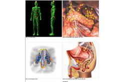 China Newest Metatron Hunter NLS System 4025 Bioresonance Health Scan and Therapy supplier