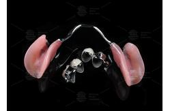 China Adjustable Multi Functional ERA Precision Attachment Removable ERA Attachments For Dentures supplier