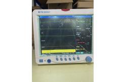 China User-friendly 6 Parameter Patient Monitor with Audible and Visual Alarm supplier