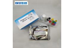 China HAV IgM Elisa Test Kit Plate Human Use 96 Tests Per Box supplier