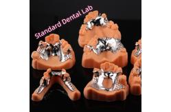 China CAD CAM Removable Partial Denture Metal Framework 3Shape Exocad Denture Design supplier