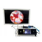 High Resolution 1080P Endoscope Full HD Endoscopic Camera Endoscopy System for Medical