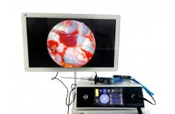 China High Resolution 1080P Endoscope Full HD Endoscopic Camera Endoscopy System for Medical supplier