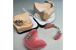 China High Esthetics CAD CAM Tooth Partial Denture Attachment Replacement Standard Dental Lab supplier