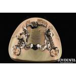 Customized Suppleness Metal Framework Dental Biocompatible Material for sale