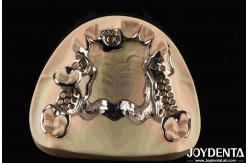 China Customized Suppleness Metal Framework Dental Biocompatible Material supplier