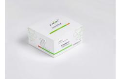 China ICU Pediatrics CRP Rapid Test Kit 60ul Sample PCT Rapid Test supplier