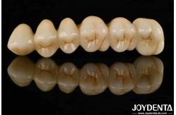 China White Full Zirconia With High Resistance To Thermal Shock High Strength supplier