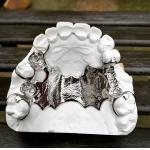 Cobalt Chrome Removable Partial Denture Framework Laser Printing Ni Be Free for sale