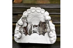 China Cobalt Chrome Removable Partial Denture Framework Laser Printing Ni Be Free supplier