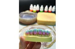 China Dental PFM Crown manufacturer