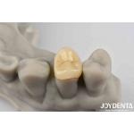 Secure Cementation Emax Inlay Onlay Easy To Clean And Resistant To Staining for sale