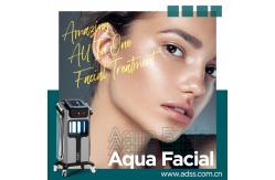 China Deep Clear Oxygen Bubble Aqua Peeling Dermabrasion Blackhead Remover Vacuum Machine supplier