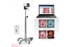 China EDAN C3A&C6A Video Colposcope supplier